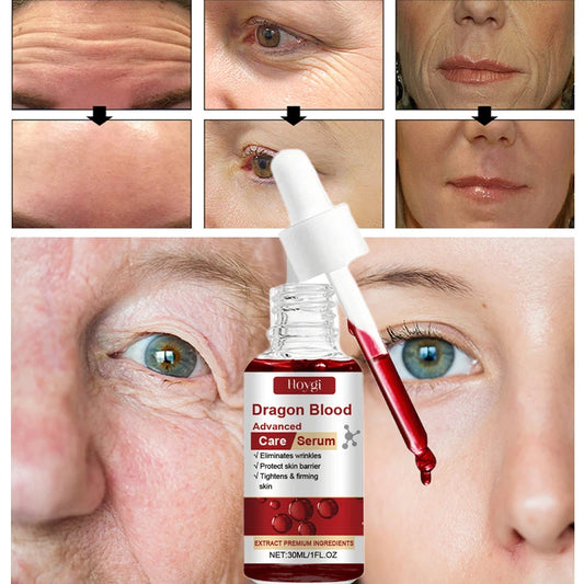 Dragon Blood Advanced Serum Effective Resist Aging Tighten Skin Reduce Wrinkles Brighten Skin Tone Improve Dullness Face Essence