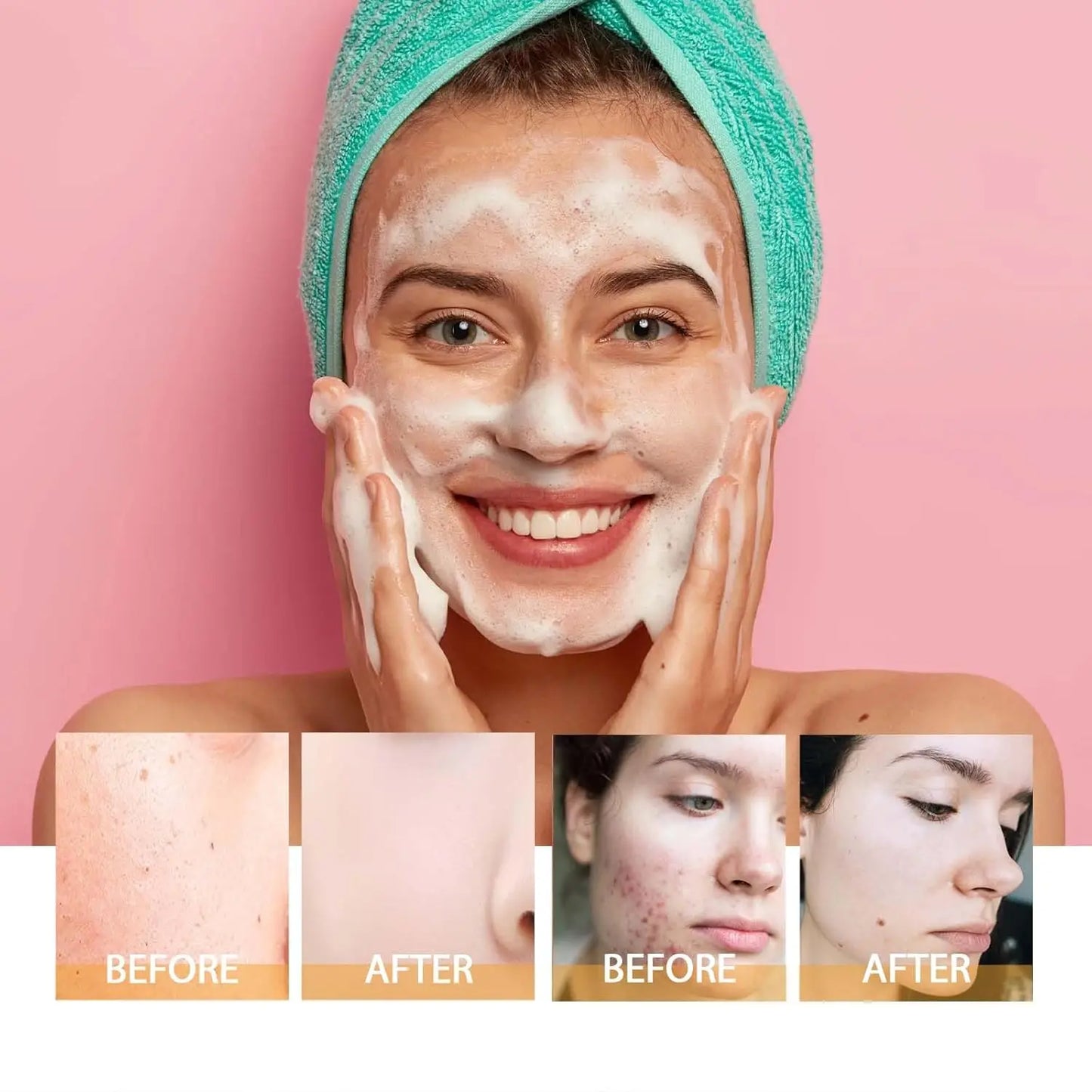 Turmeric Kojic Acid Blackhead Remover Cleanser Deeply Cleansing Skin Cleansing Oil Control Fade Acne Marks Brighten Foam Cleanse