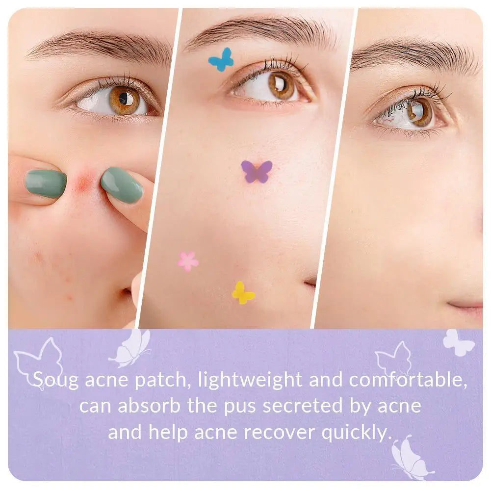 240Pcs Cute Star Acne/Pimple Patch Acne Treatment Stickers Invisible Acne Stars Cover Face Spot Removal Pimple Patch Skin Care