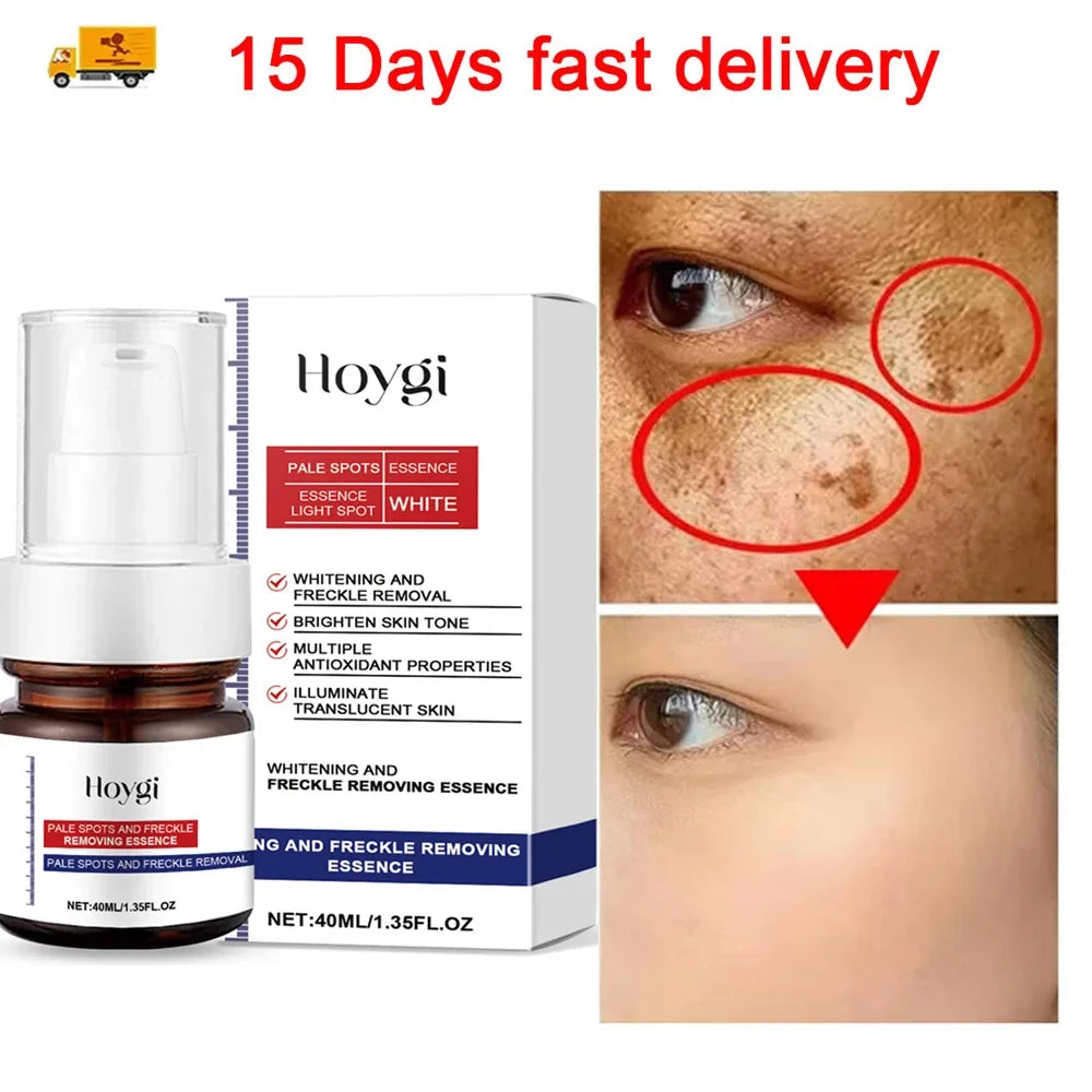 Powerful Dark Spots Remover Whiten Serum Cream Vitamin C Skin Brighten Serum Removal Melasma Dark Spots Repair Beauty Skin Care
