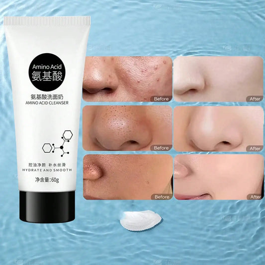 Amino Moisturizes Acid Facial Cleanser Deeply Cleans Dirt Controls Oil Enriches Foam