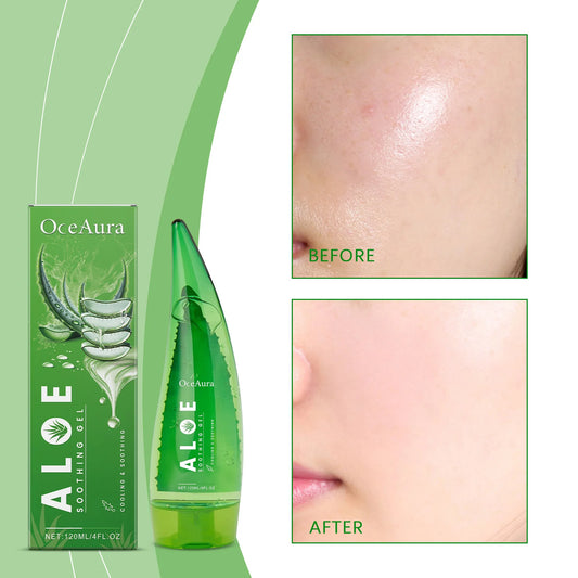 Aloe Vera Gel Skin Lightening Moisturizing Tone Acne-removing Natural Organic Aloe Vera Gel After-sun Moisturizing Cream 120ml