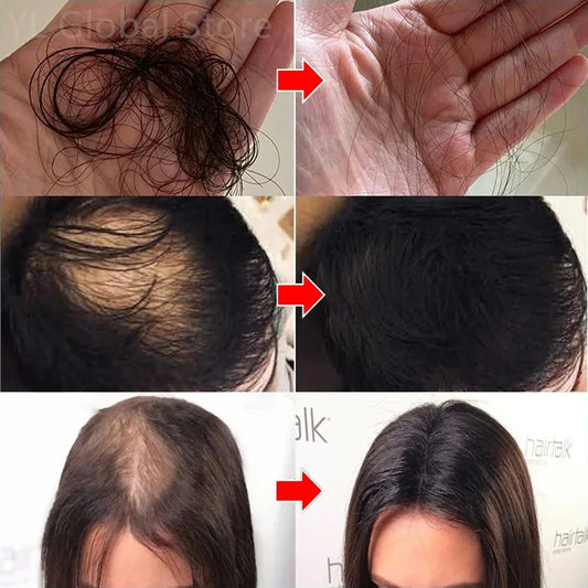Rosemary Hair Growth Serum Anti Hair Loss Baldness Fast Regrowth Hair Care Oil Repair Damaged Hair Scalp Treatment For Women Men