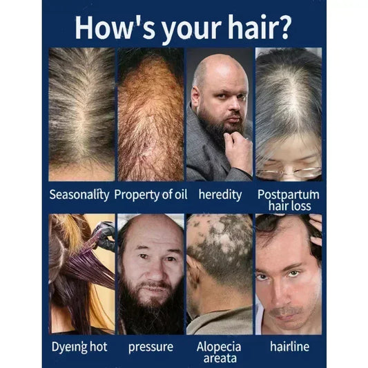 Effective Hair Growth Oil Loss Repair Genetic Hair Loss Postpartum Hair Loss Seborrheic
