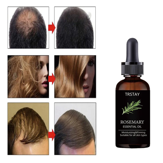 TRSTAY Rosemary Essential Oil for Hair Care Improves Damaged Hair Dredges Blocked Follicles Activates And Growth Lubricates Hair