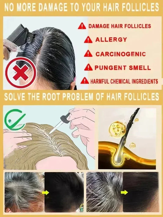 Natural Anti Gray Hair Serum | Nourishing Hair Care Remedy - Repair White & Darkening Hair