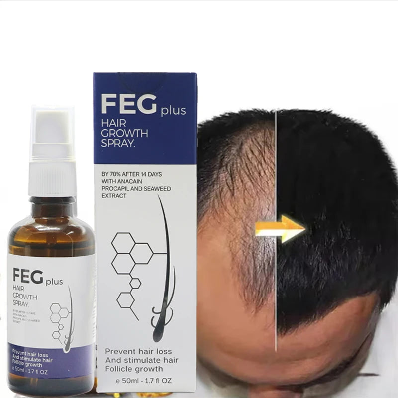 2pcs FEG hair growth spray original Organic Anti Hair Loss Hair Growth Treatment Oil For Thicker Long Hair -50ML