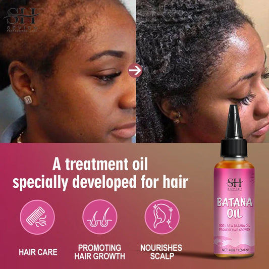 African Batana Oil Serum Hair Loss Hair Regrowth Treatment Serum Fast Repair Baldness Hereditary Postpartum Seborrheic Men Women
