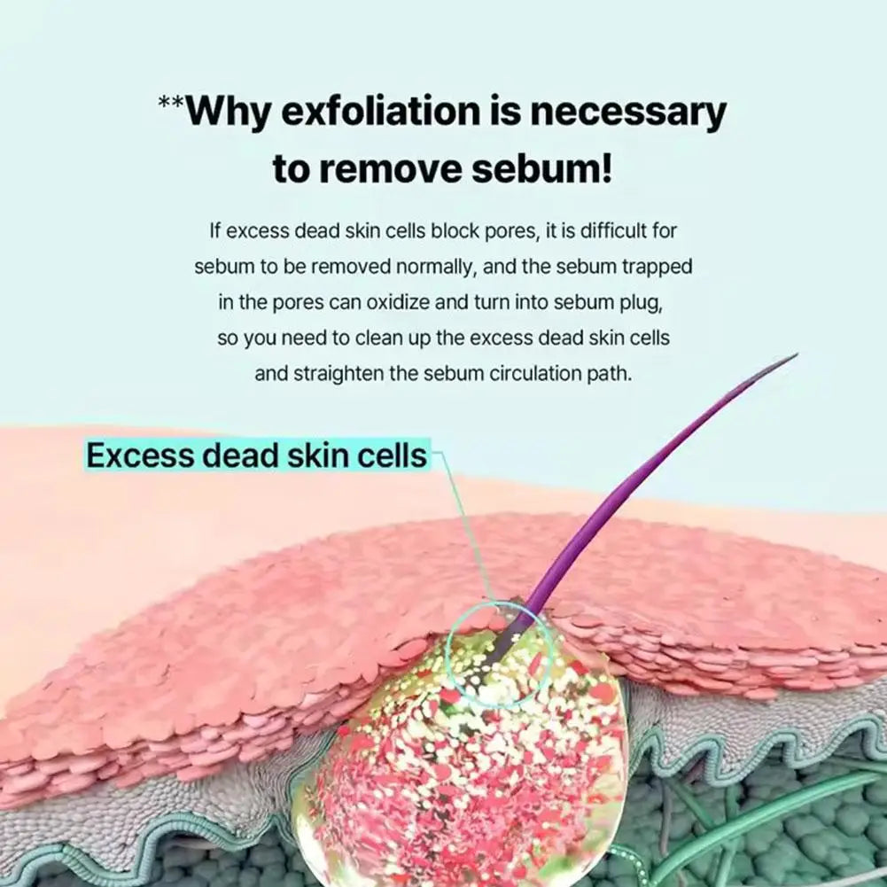 Super Melting Serum Softener Blackhead & Acne Removal Oil-Control Gentle Deep Cleaning Shrinks Pores Facial Repair Serum