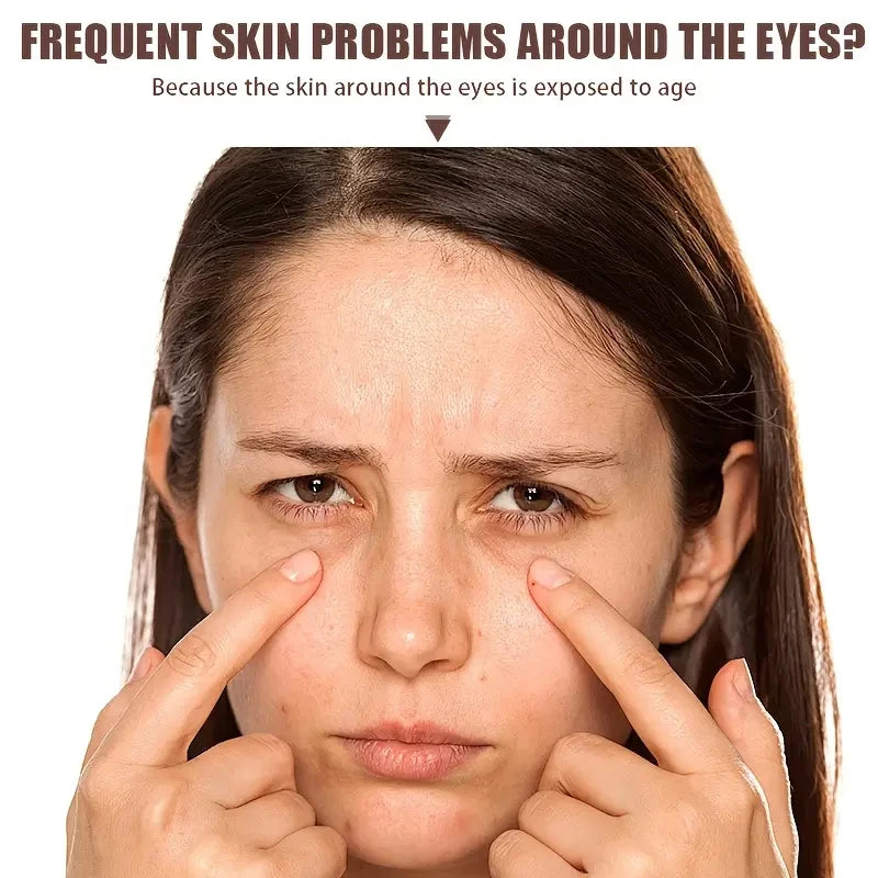 Bee Venom and Caffeine Eye Cream for All Skin - 20g, Deeply Nourishes and Tightens, Contains Aloe Vera and Avocado, Alcohol-Free