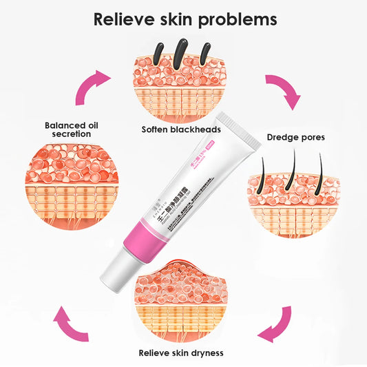 30ml 15% Azelaic Acid Purifying Gel Salicylic Acid Pore Shrinking Cream Acne Treatment Blackhead Removal Face Deep Cleaning Gel