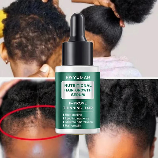 7 Days Fast Hair Growth Serum Prevent Hair Loss Hair Regrowth Essential Oil Repair Damaged Hair Roots Hair Care For Women Men