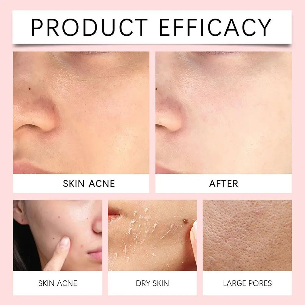 Himalayan Salt Centella Asiatica Cleanser Deep Cleansing Foam Removes Impurities Gentle Refreshing Facial Cleanser 114g