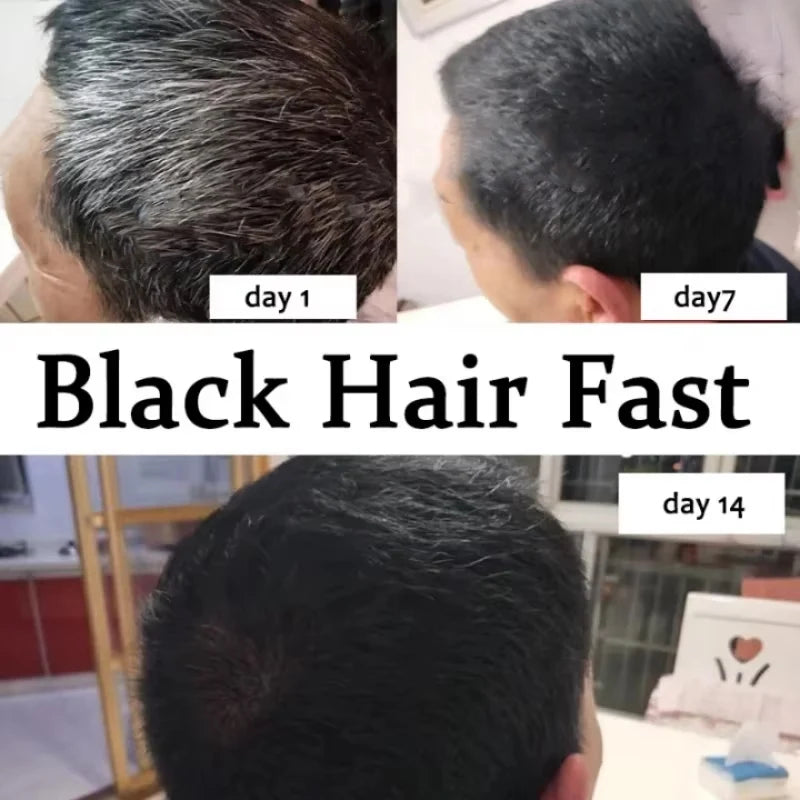 Gray White Hair Treatment Serum Cover White Hair To Black Natural Color Repair Spray Anti Loss Hair Restore Healthy Hair Care