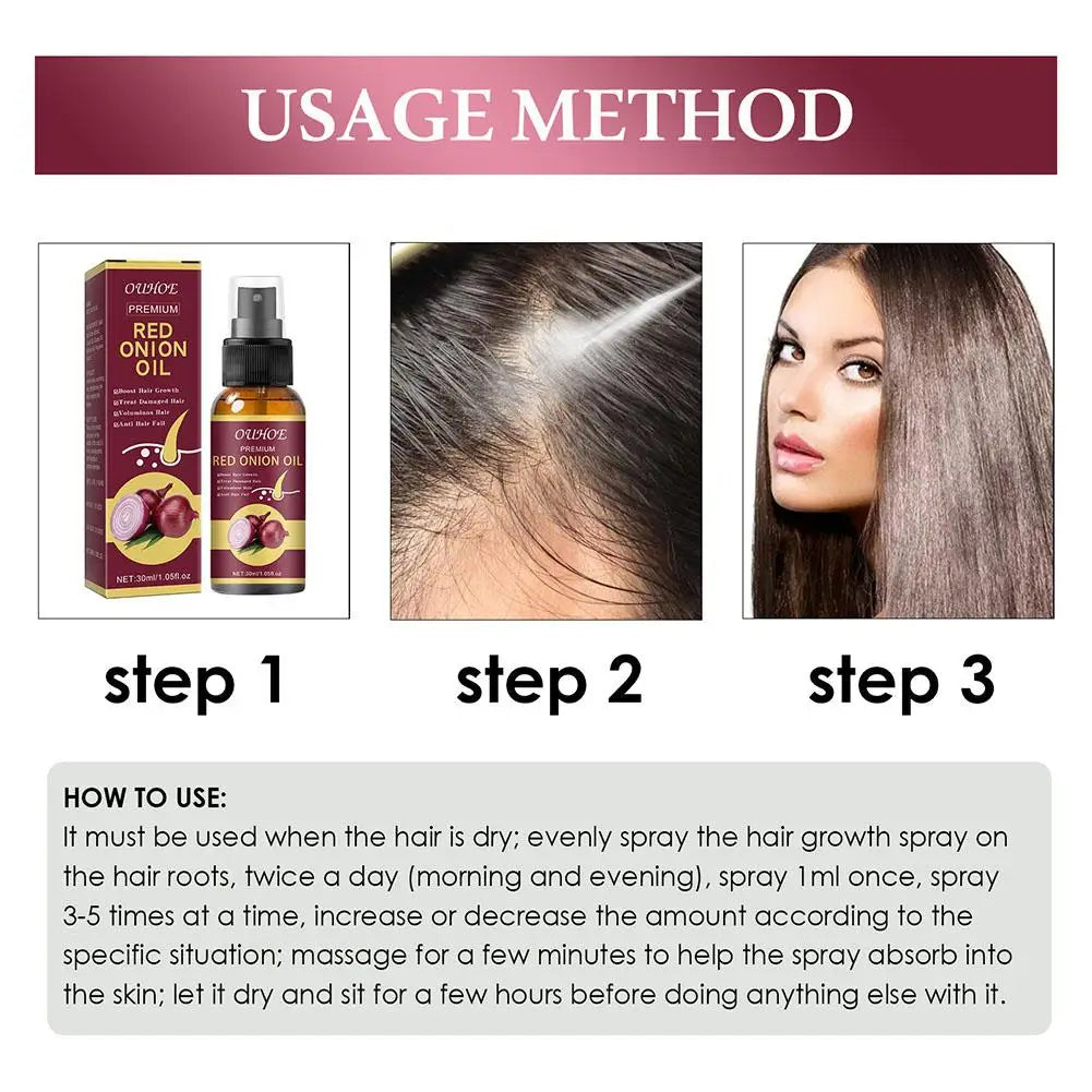 Red Onion Hair Growth Essential Oil Hair Care Spray Prevent Hair Loss Nourish Hair Roots Improve Hair Texture Hair Care Products