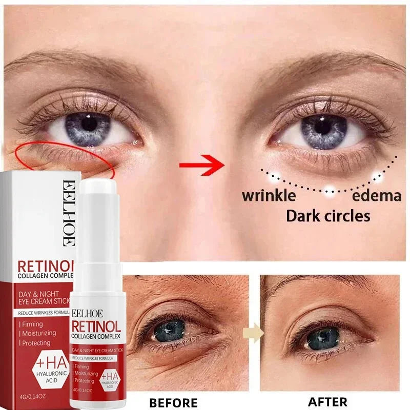 Retinol Wrinkle Removal Facial Kit Instant Firming Enhancement Anti Aging Serum Fading Fine Line Whitening Korean Skincare