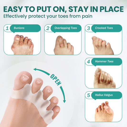 2/4/6/8Pcs Aloe Vera Infused Toe Straighteners Bunion Hammertoe Silicon Four Hole Toe Separator Bunion Hallux Valgus Correction