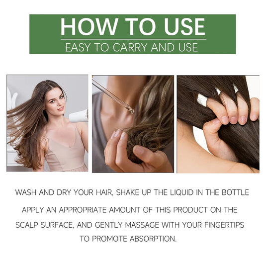 YOUNGCOME Rosemary hair care essential oil, Nourishes Improves Frizz Prevents Hair Loss Hair Care Scalp Treatment Anti Dandruff