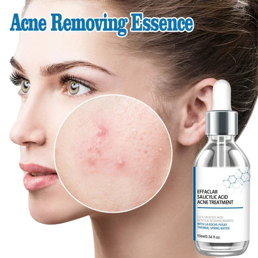 Salicylic Acid Solution Essence Shrink pores and Acne Spot Removing Shrink Pores Oil-Control Brighten Face Skin Makeup