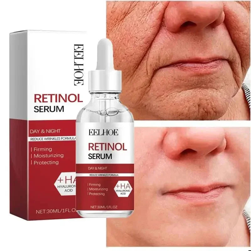 Retinol Wrinkle Removal Facial Kit Instant Firming Enhancement Anti Aging Serum Fading Fine Line Whitening Korean Skincare