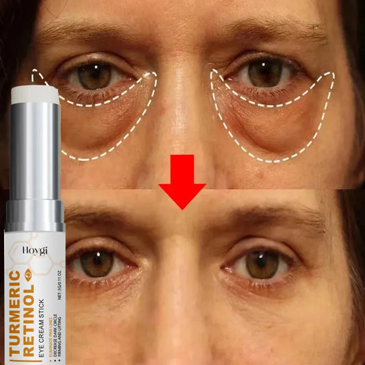 Instant Eye Bag Remove Eye Cream Anti Fat Particles Dark Circles Puffiness Fade Fine Lines Lift Brighten Korean Beauty Eye Care