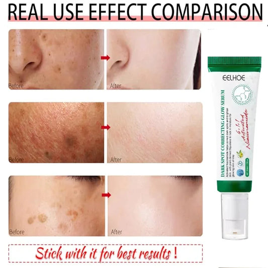 Dark Spot Corrector serum Fades Sunspots Brightens Dull Skin Nourishes skin Reduces Melanin Minimizes freckle for men and women