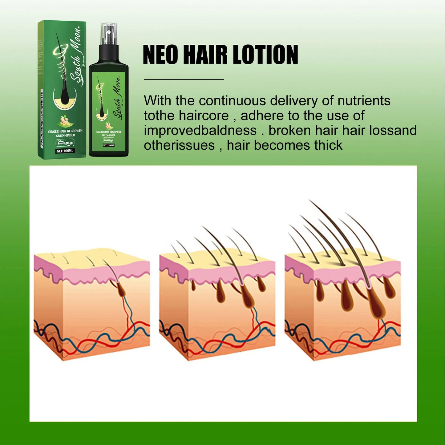 Hair Growth Spray Effective Nourishing Root Hair Thick Growth Liquid Anti Hair Loss Ginger Anti-fall Scalp Massage Care Spray