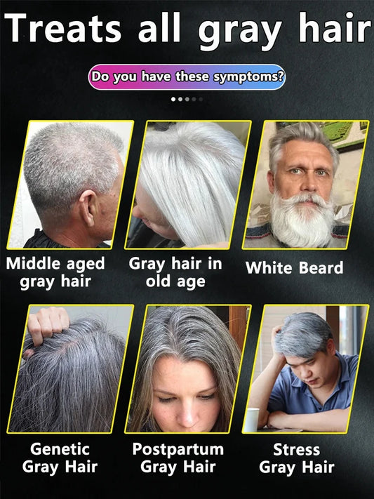 Let your gray hair return to its natural color, even if you are 80 years old, it will be effective and will not recur again
