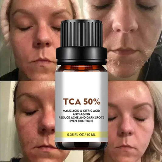 With Malic Acid And Citric Acid For Face Facial Peel 40% Peeling Serum Peeling Serum Chemical Peel