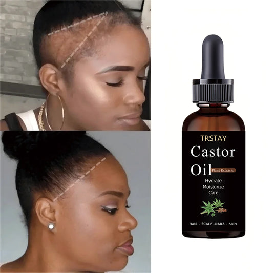 TRSTAY Jamaica Black Pure Natural Castor Oil Hair Treatment Moisturizing Strong Scalp Environment Healthy Hair Care