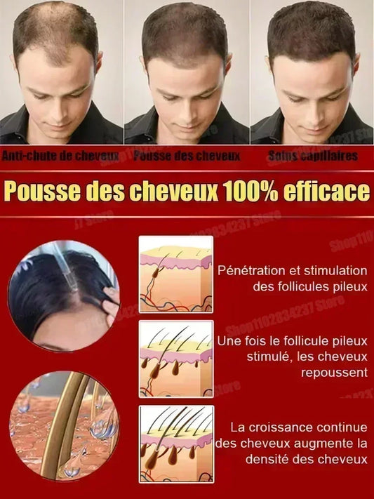 Get Fuller and Healthier Hair with Hair Care Essential Oils - Hot Selling Product