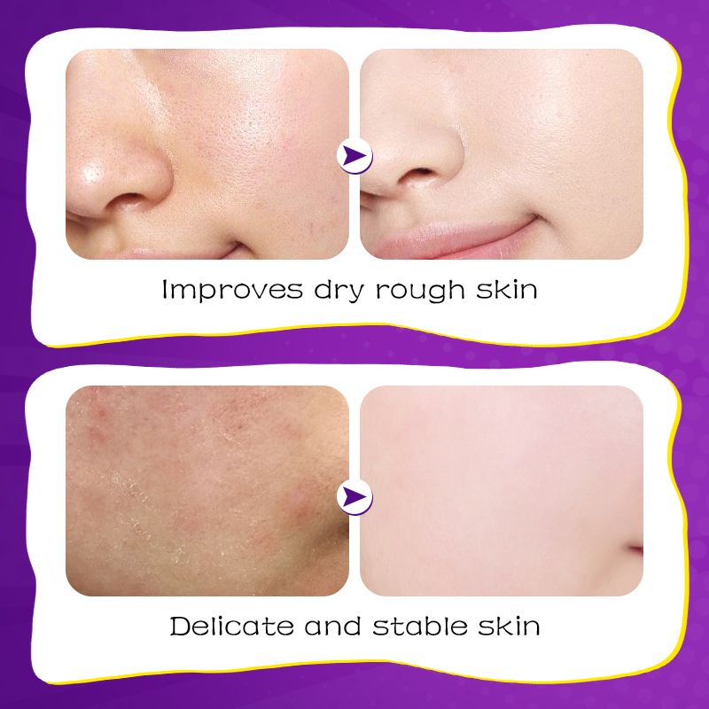 9 PCS Facial Mask Moisturizing Repair Brightening Tender Anti Oxidant Face Care Skin Care