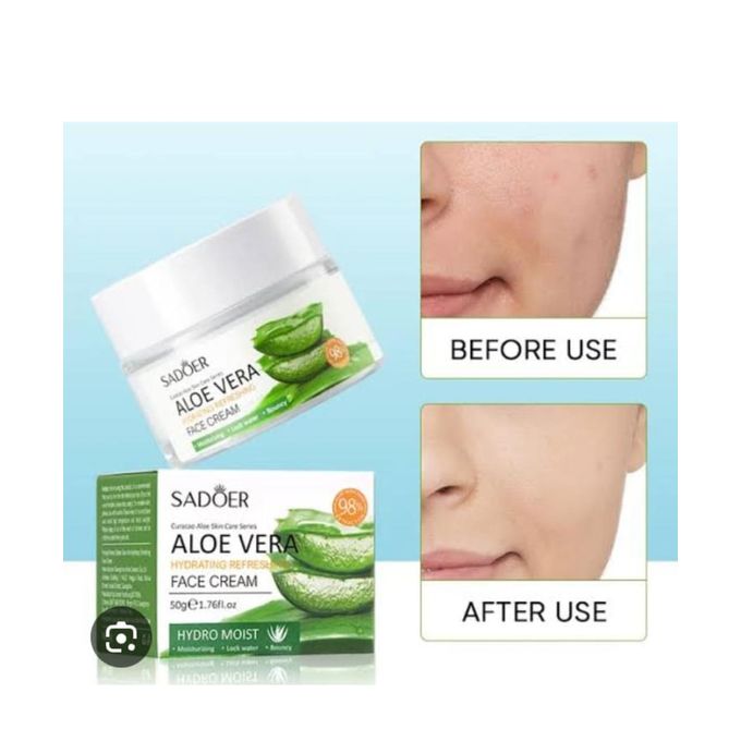 Aloe Vera Face Cream – Hydrating & Soothing Skin Care