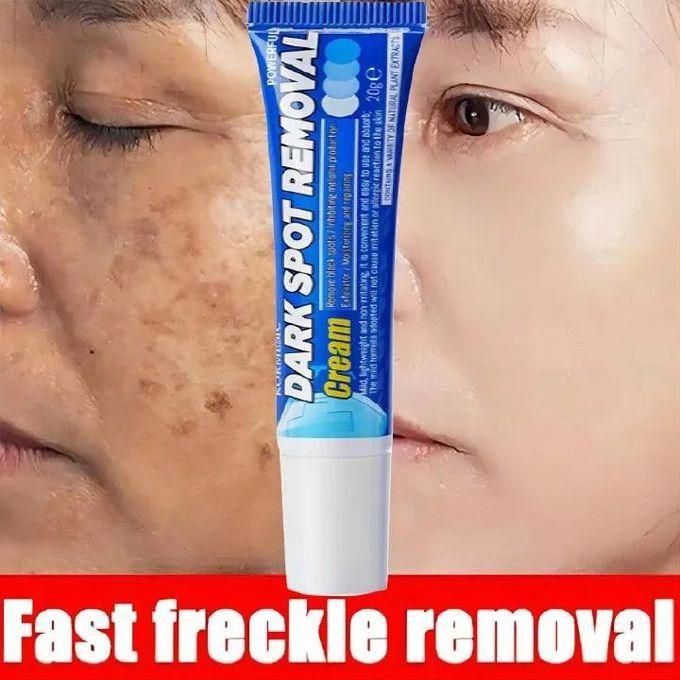 Dark Spot Removal Cream