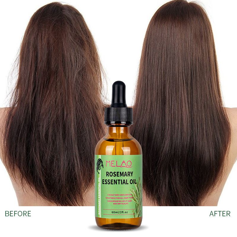 Rosemary Mint Hair Growth Oil - Scalp Treatment for African Hair | Strengthens & Prevents Breakage (Natural Ingredients, Curly Hair Care, 3x Thicker, Gift Set)