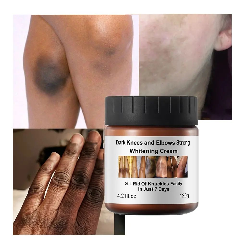 MOOYAM Dark Knees, Elbows and Knuckles Strong Whitening Cream In 7 Days Brightening