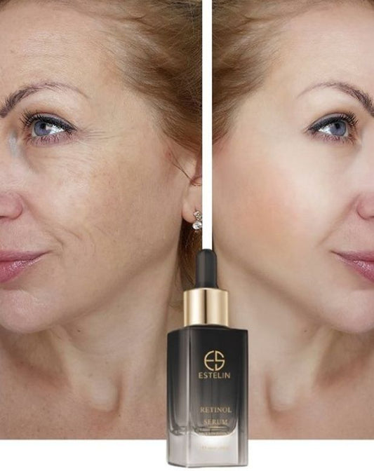 Estelin Retinol Anti-Wrinkle Serum - Youth Activating Bottle