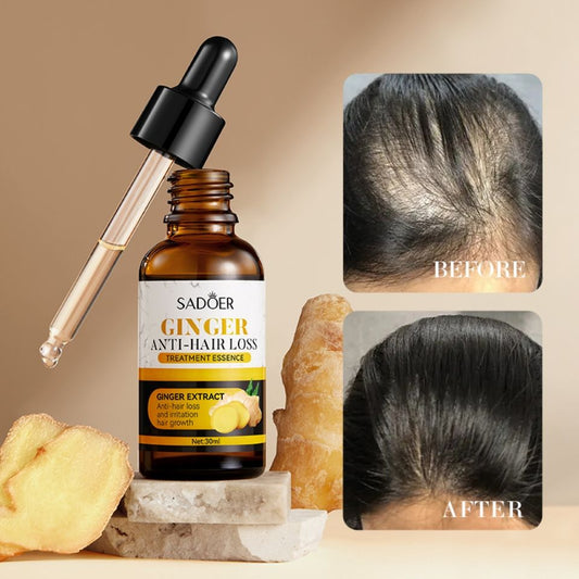 Hair Growth Oil Serum Sadoer Ginger Essence Hair Care Serum Hair Softening and Hair Moisturizer for best hair growth results Anti Hair Loss Treatment Essence 30ml