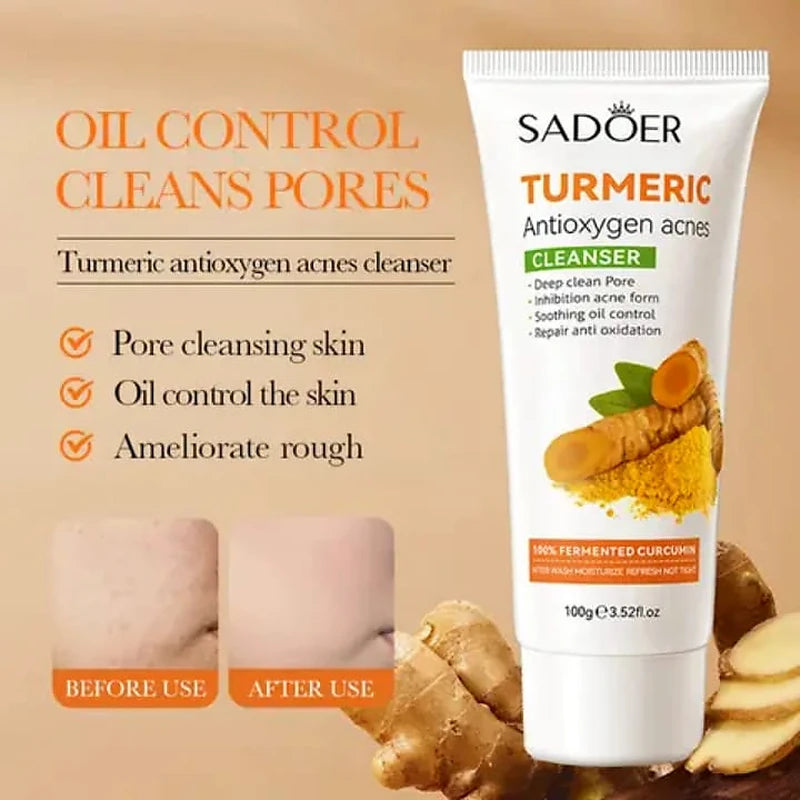 Sadoer Turmeric Antioxidant Acnes Cleanser tube with before and after use images on a beige background