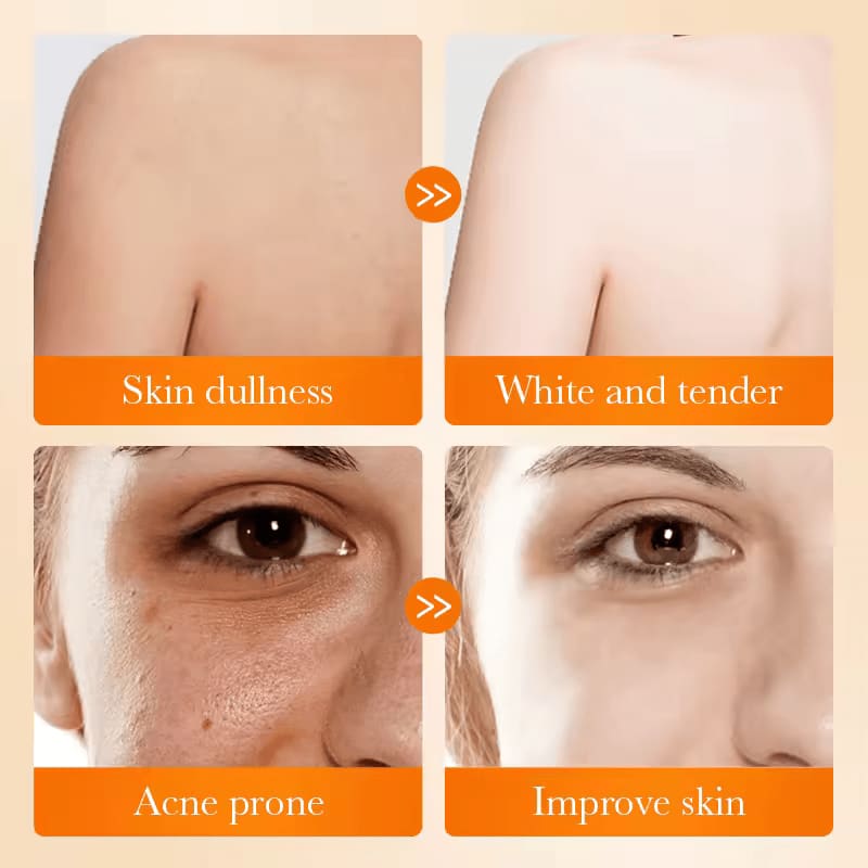 Sadoer 3 Pieces Kojic Soap, Kojic Acid Soap, For Anti Acne, Deep Cleaning and Like Vitamin C, Skin Brightening and Whiten Dark spots