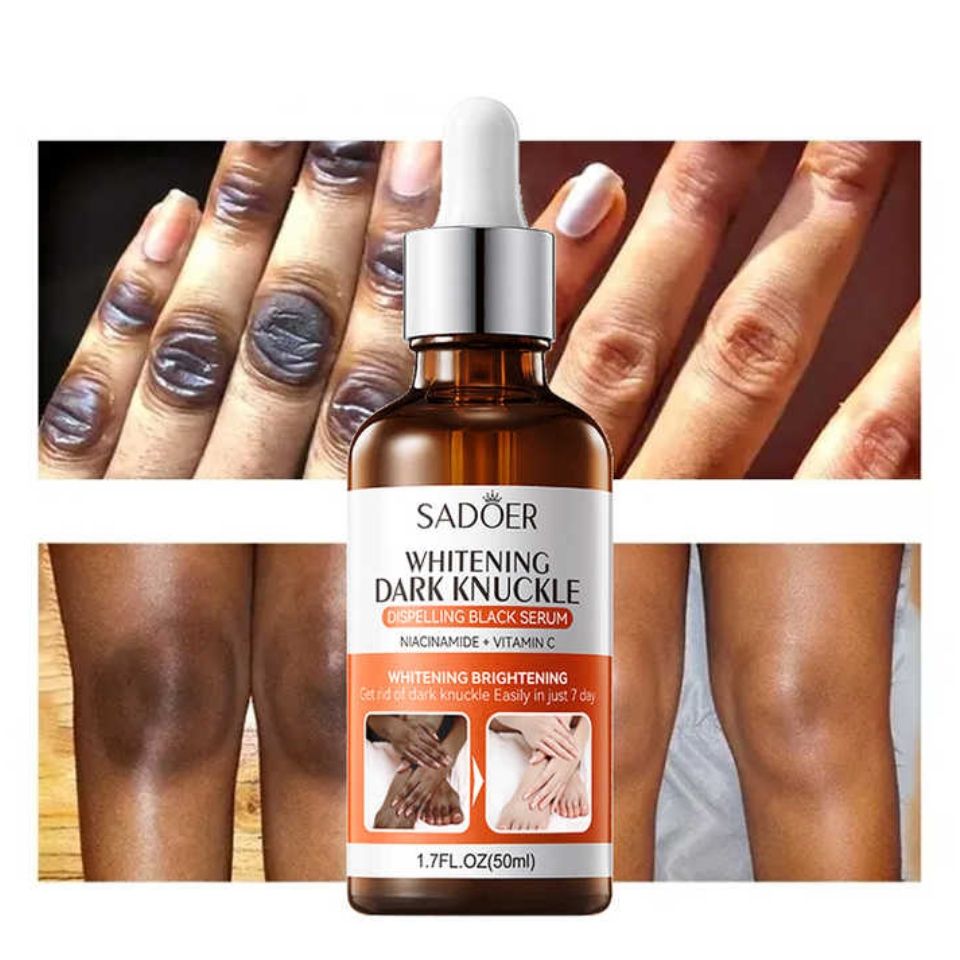 SADOER Dark Knuckles Whitening Brightening Serum Elbows,Knees, Fingers Hand Whitener Fingers Brighten Moisturize Black Dark Skin Spot Lighten Stains Remover Essence Products