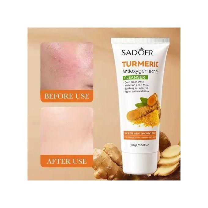 Turmeric Cleanser Anti Acnes Facial Cleanser