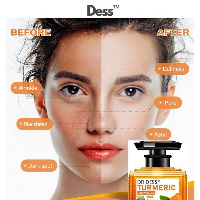 Turmeric shower gel