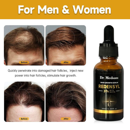 Castor oil Biotin Hair Growth Solution Hair Growth Rosemary Hair Essence Hair Care Loss Products