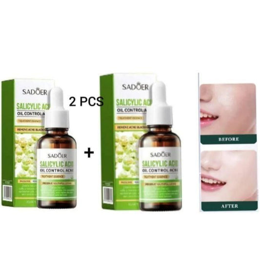 2 Pcs Salicylic Acid Serum For Face Shrink Pores, Gentle Exfoliating, Salicylic Acid For Anti Acne, Pimple, Spot, Blackhead Salicylic Acid Acne...
