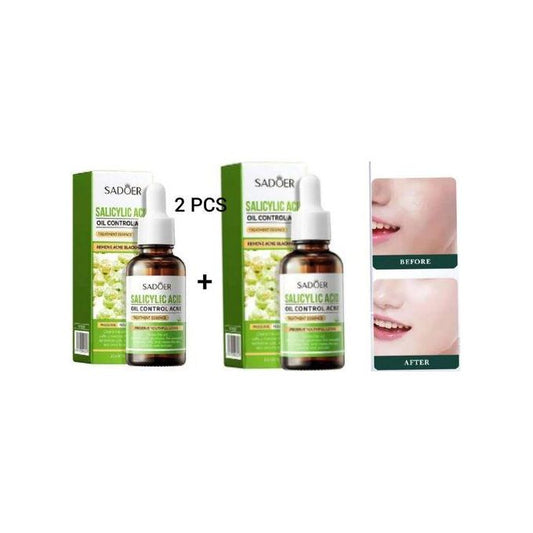 2 Pieces Salicylic Acid Serum For Face Shrink Pores, Gentle Exfoliating, Salicylic Acid For Anti Acne, Pimple, Spot, Blackhead Salicylic Acid Acne...