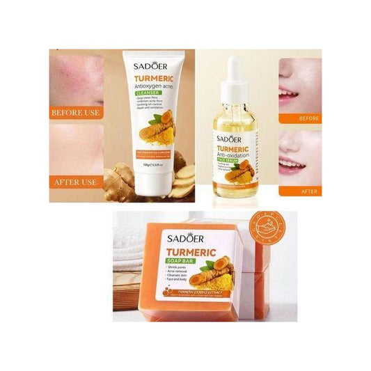 3 in 1, Turmeric Serum + Turmeric Cleanser + Tumeric Soap, Anti Ace, Oil Control and Moisturizing Combo