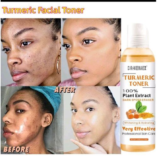 DR MEINAIER 2 Pcs : Tumeric Toner 100% Plant Extract Dark Spots Eraser
