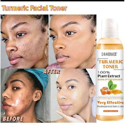 DR MEINAIER 2 Pcs : Tumeric Toner 100% Plant Extract Dark Spots Eraser