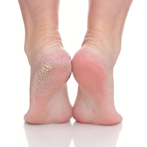 Silicone Moisturizing Socks For Softening Dry Cracked Feet Rough Skins